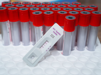 STI Cases in Europe Hit a Decade High — Gonorrhoea Up 303%, Congenital Syphilis Nearly Doubled