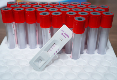 STI Cases in Europe Hit a Decade High — Gonorrhoea Up 303%, Congenital Syphilis Nearly Doubled