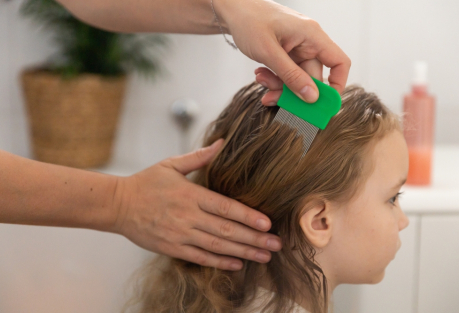 Head Lice: What to Do If an Outbreak Is Detected at Your School in Valencia