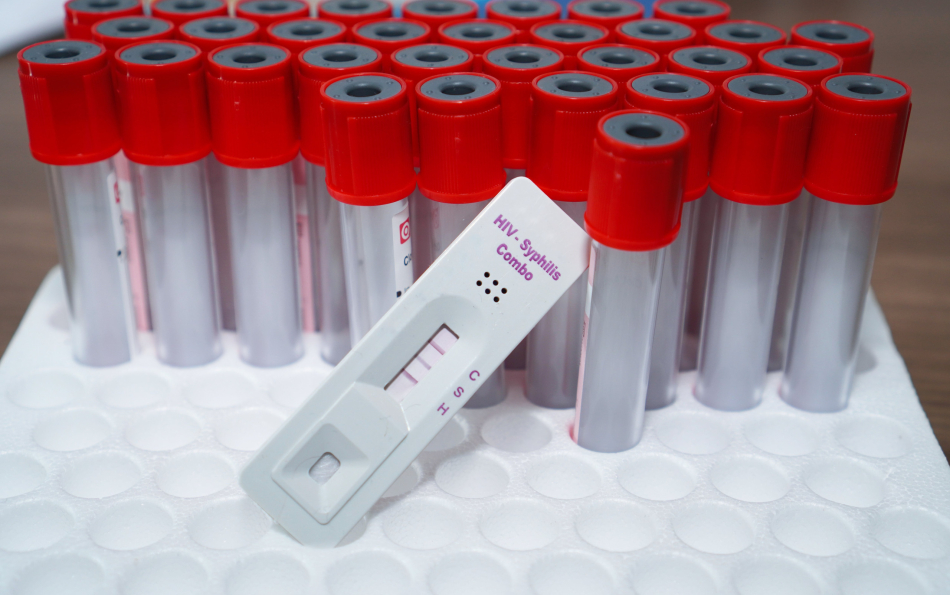 STI Cases in Europe Hit a Decade High — Gonorrhoea Up 303%, Congenital Syphilis Nearly Doubled