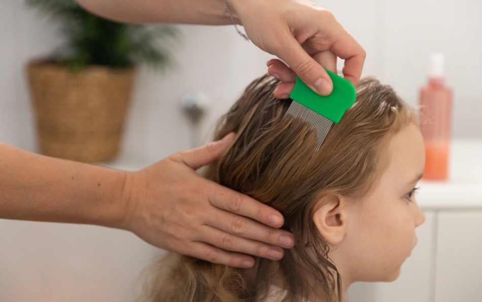 Head Lice: What to Do If an Outbreak Is Detected at Your School in Valencia